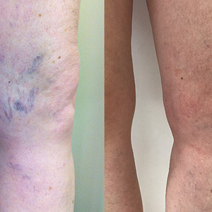 Julia's journey:
