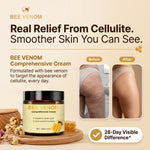 Anti Cellulite System - Bee Venom Ointment & 8 Herbal Extracts