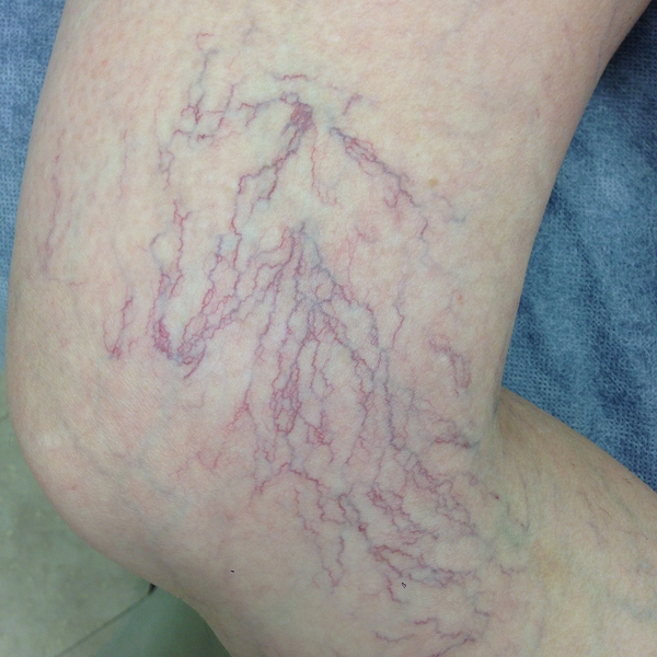 Jane, 45 before